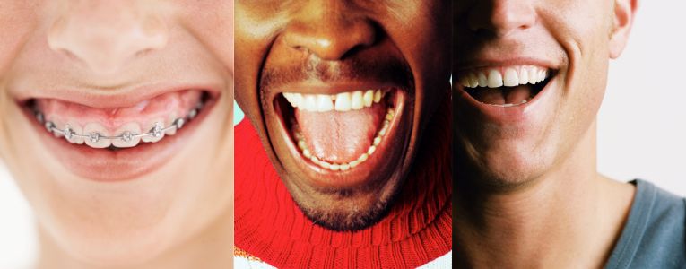 3 smiling mouths